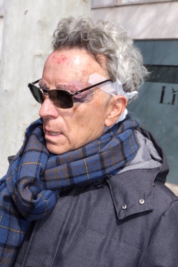 José Ortega Cano, molt inflamat després d'una operació - Europa Press