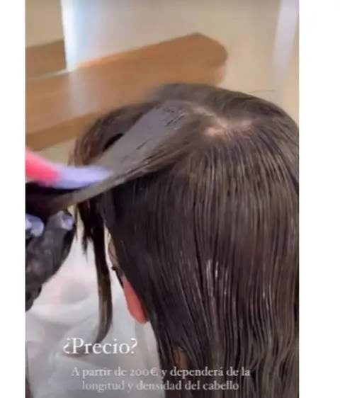 Laura Escanes reconeix que té un problema d'alopècia - Instagram