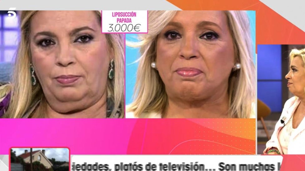 Carmen Borrego analitza el seu canvi físic - Telecinco