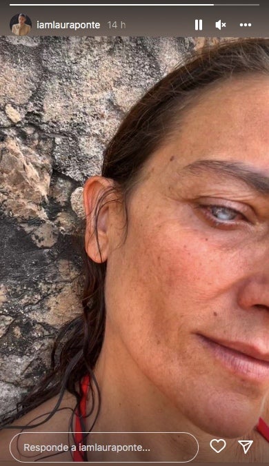 Laura Ponte mostra com té l'ull ara que ha perdut la visió - Instagram