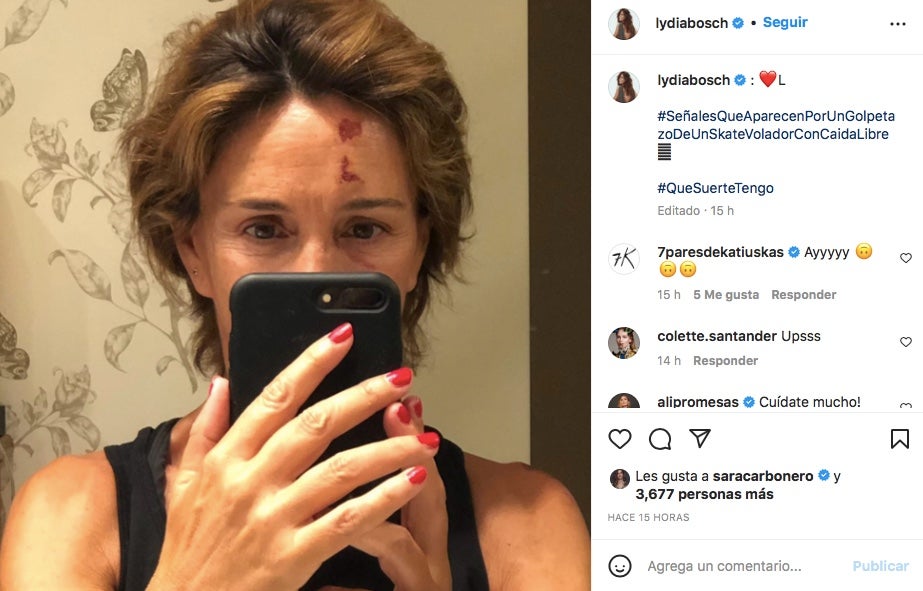 Lydia Bosch pateix un accident - Instagram
