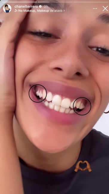 Chanel crida l'atenció amb una dentadura estranya - Instagram