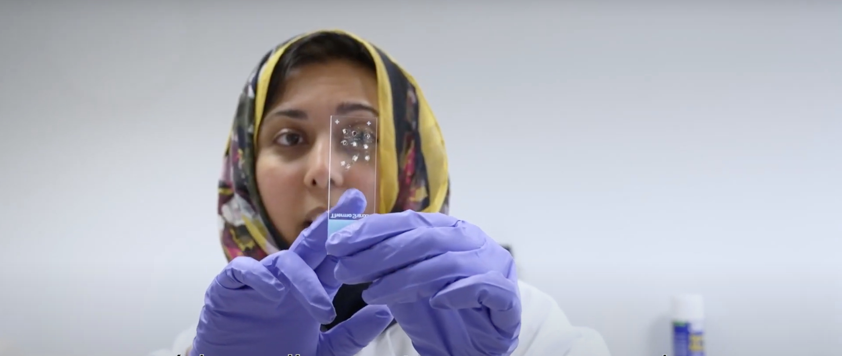 La investigadora que ha descobert com es podria recuperar les neurones malmeses del nervi òptic / Cedida