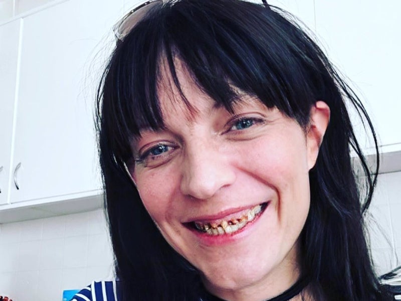 El hijo de Camilo Sesto, con la dentadura fatal - Instagram