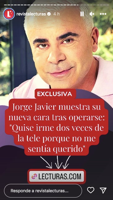 Jorge Javier Vázquez es fa un altre retoc estètic - Instagram