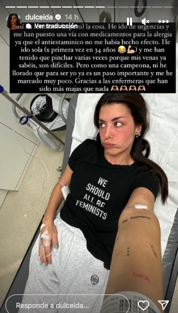 Dulceida ha patit un atac d'al·lèrgia fort - Instagram