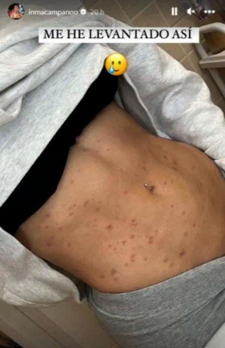 L'exconcursant de La isla de las tentaciones ha hagut d'anar a urgències - Instagram