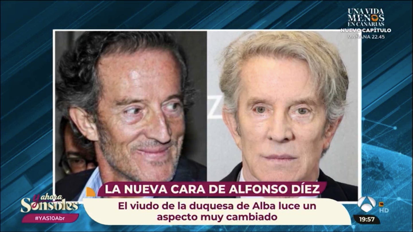El antes y lo després de Alfonso Díez - Antena 3