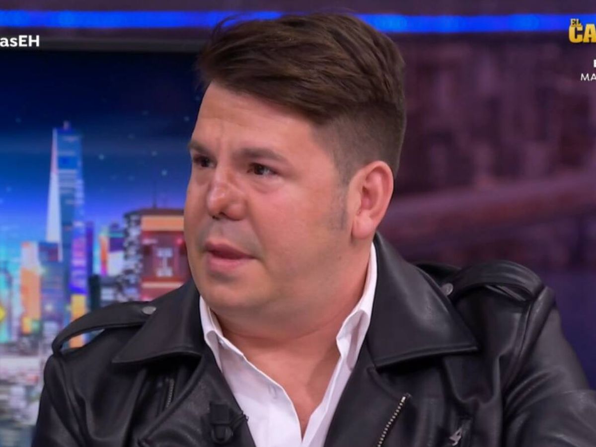 Lucas, cantant d'Andy y Lucas explica què s'ha fet al nas | Atresmedia