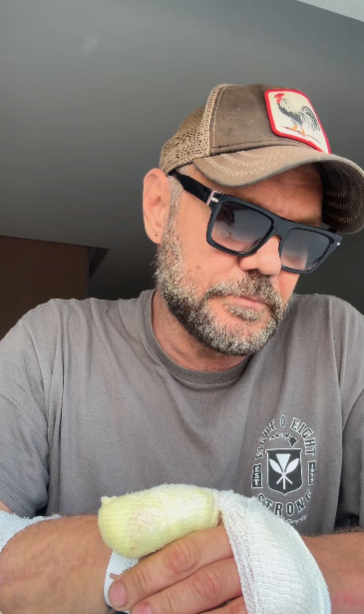 Nacho Vidal revela els motius de la seva última operació d'urgència _ Instagram