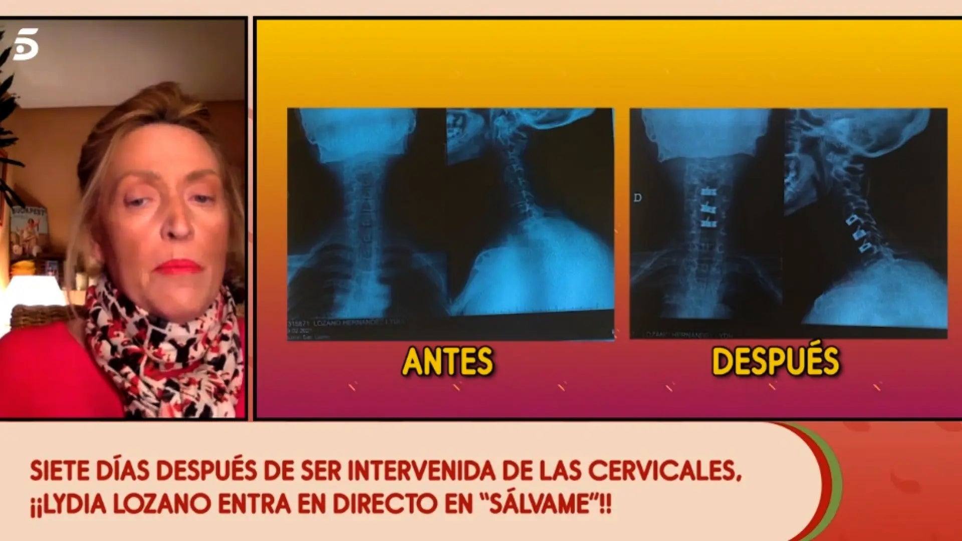Així estaven les cervicals de Lydia Lozano abans de l'operació - Telecinco