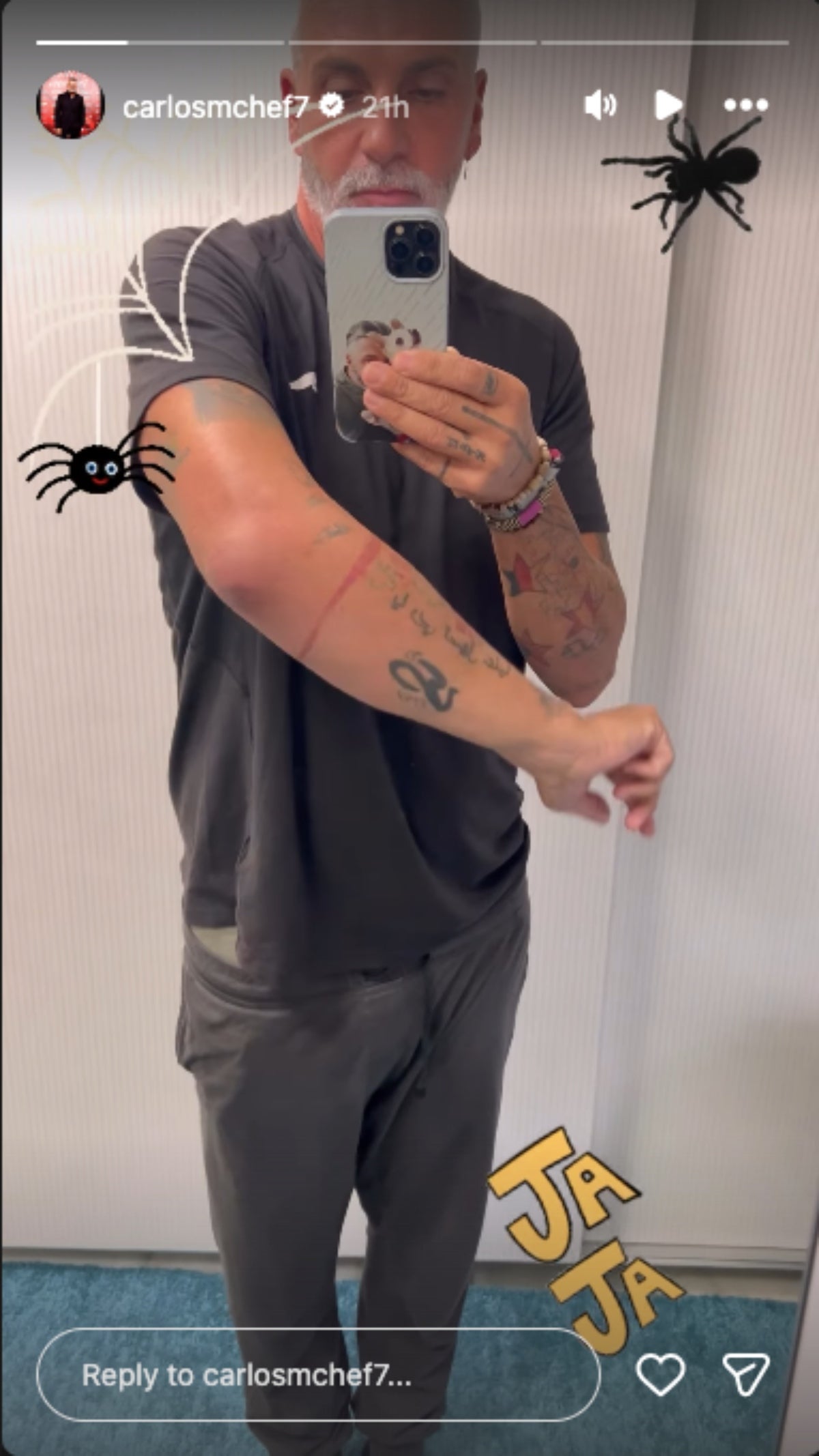 Carlos Alba explica com l'ha afectat un problema amb una picada d'aranya | Instagram