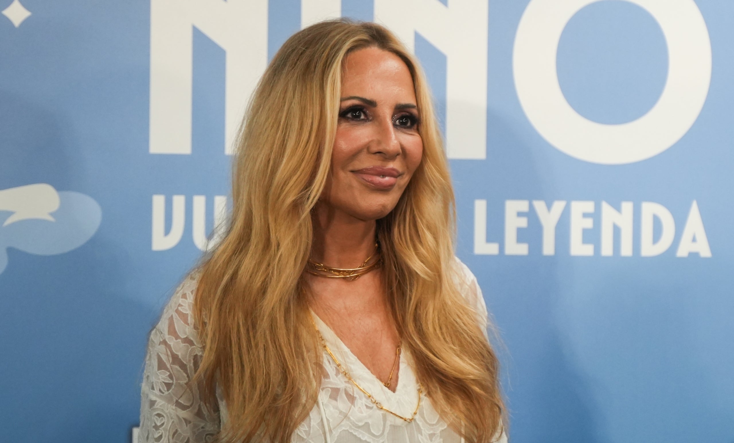 Marta Sánchez s'ha fet rètocs estètics_ Els detalls analitzats per una experta | Europa Press