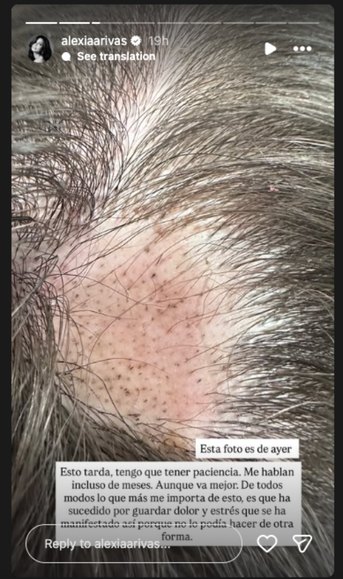 Així avança la situació d'Alexia Rivas | Instagram