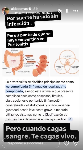 Aldo Comas explica què li ha passat - Instagram
