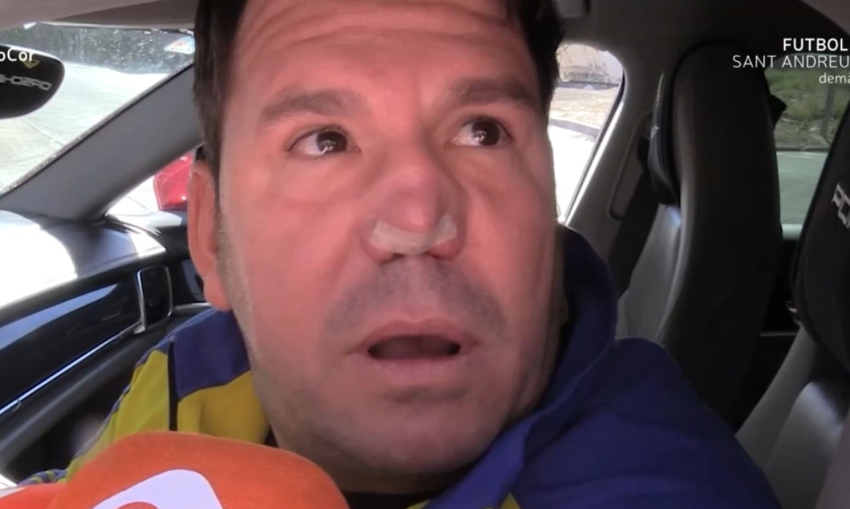 Com serà la intervenció de Lucas per arreglar-se el nas deforme? | RTVE