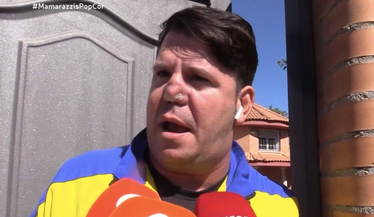 Com serà la intervenció de Lucas per arreglar-se el nas? | Europa Press