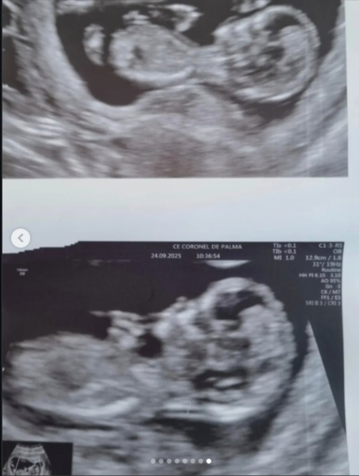 L'actor Adam Jezierski publica una ecografia del bebè que espera | Instagram