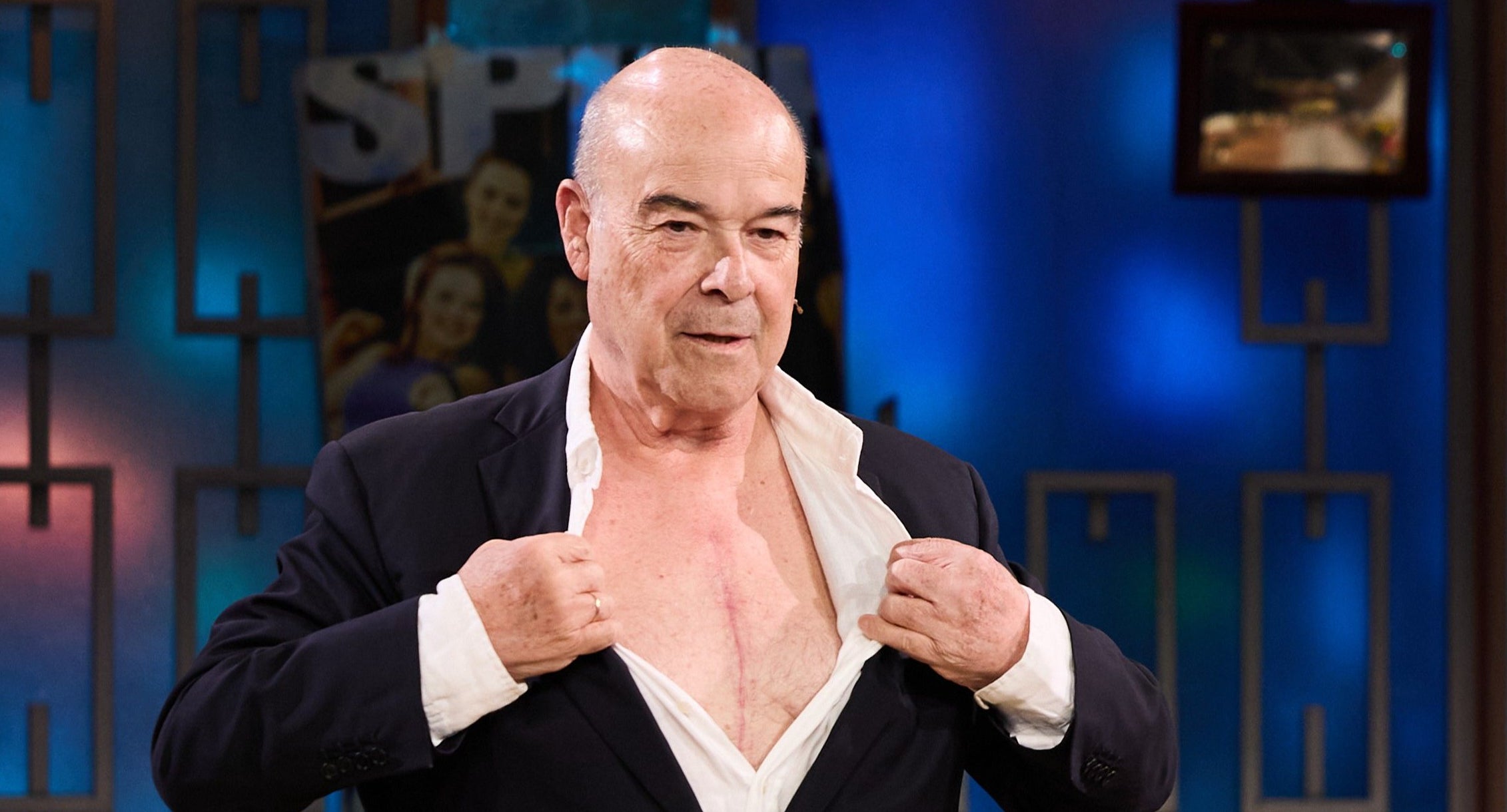 Antonio Resines mostra la cicatriu que li ha quedat de l'operació de pit -- TVE
