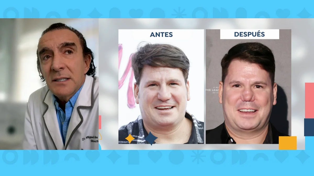 L'abans i el després del nas de Lucas demostra el drama - Antena 3