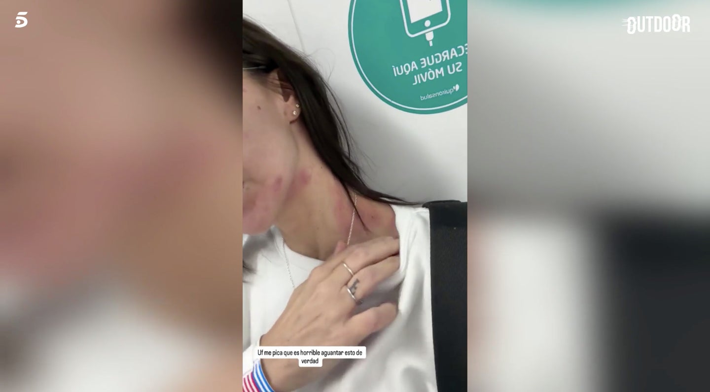 L'exconcursant mostra com està - Instagram