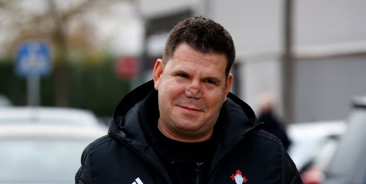 Lucas, d'Andy y Lucas, ja té data per arreglar-se el nas -- Europa Press