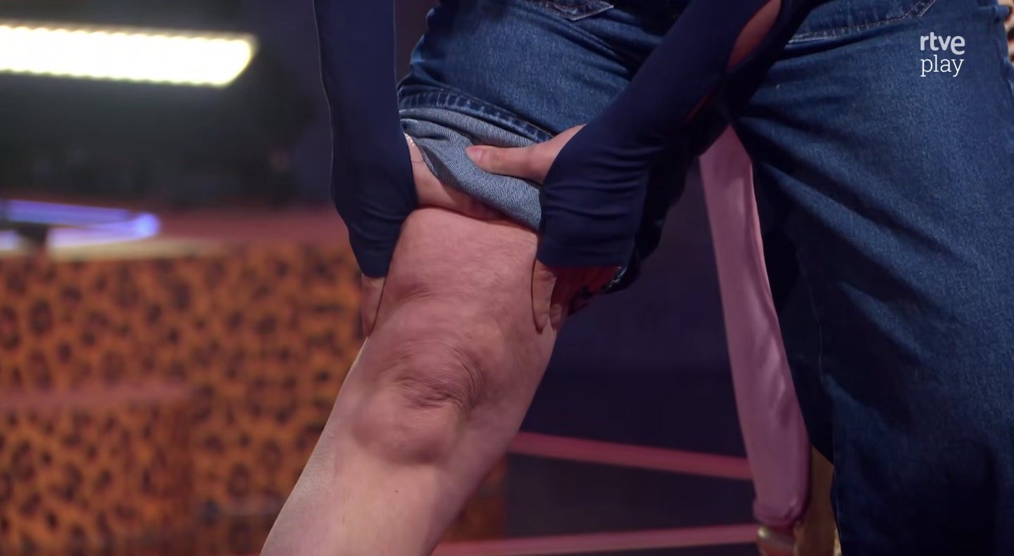 Ana Morgade ensenya la cel·lulitis en un vídeo molt aplaudit - TVE