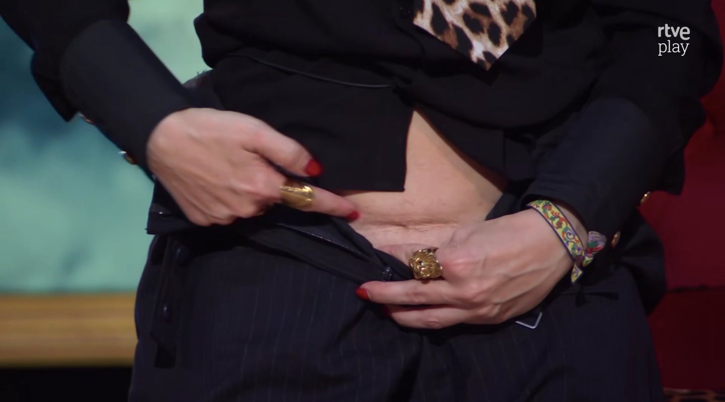 Henar Álvarez mostra la cicatriu de la seva cesària - TVE