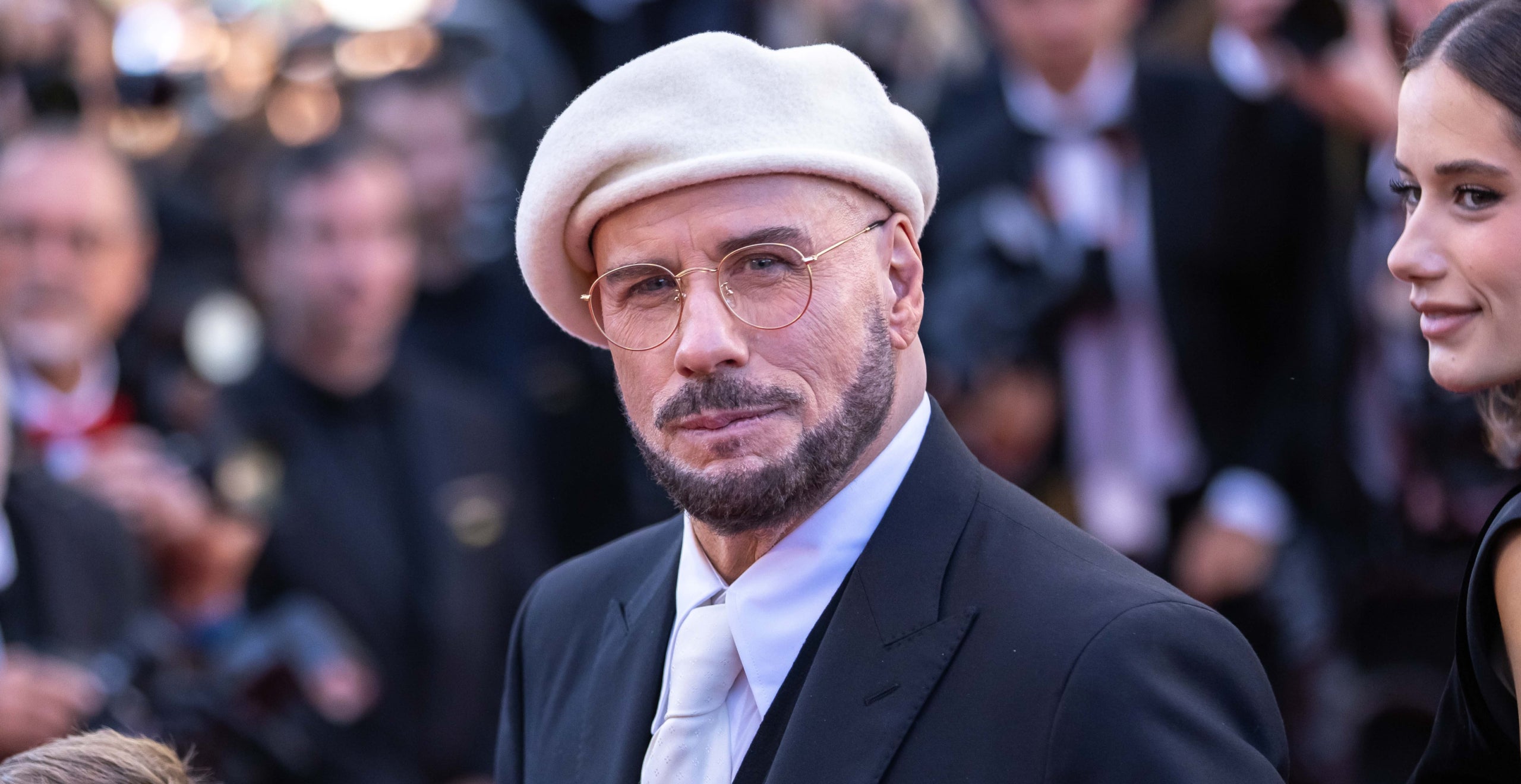 S'ha operat John Travolta_ Què diuen els experts_ - Europa Press
