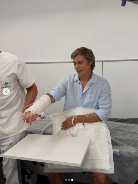Carlos Baute pateix una caiguda i es fractura el braç - Instagram