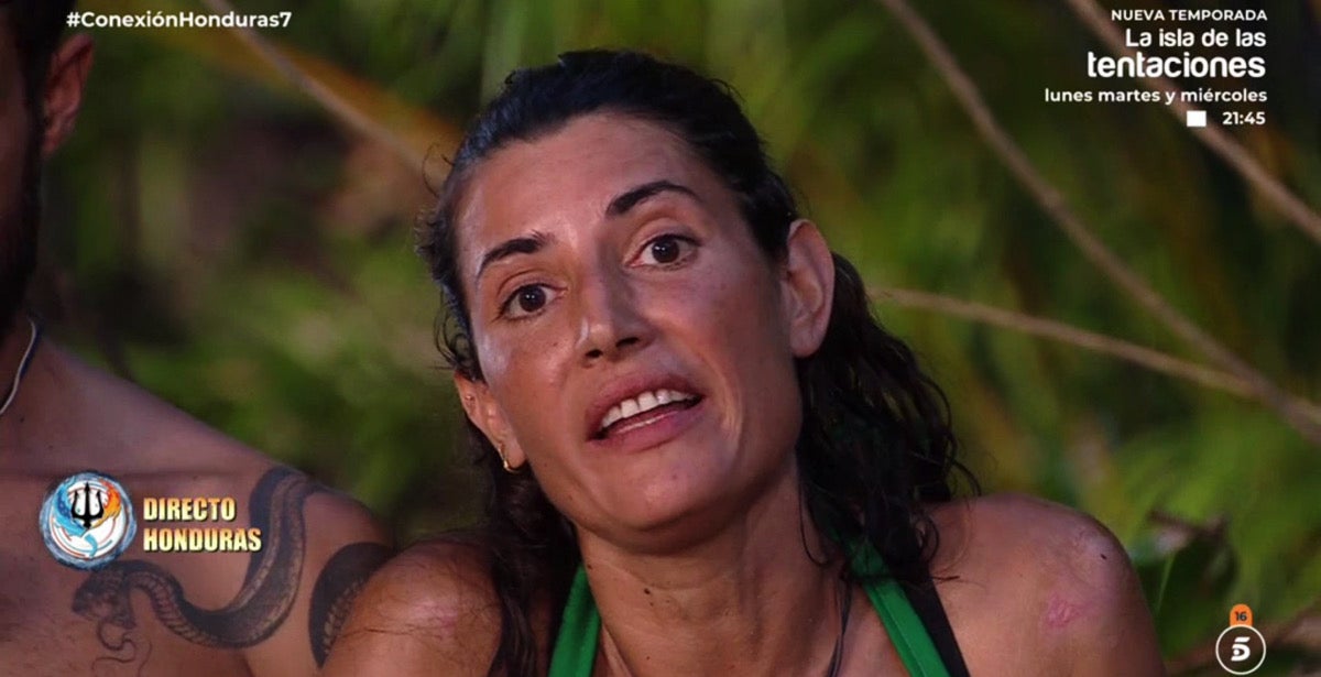 Les seqüeles que té Alba Paul després de 'Supervivientes' - Telecinco