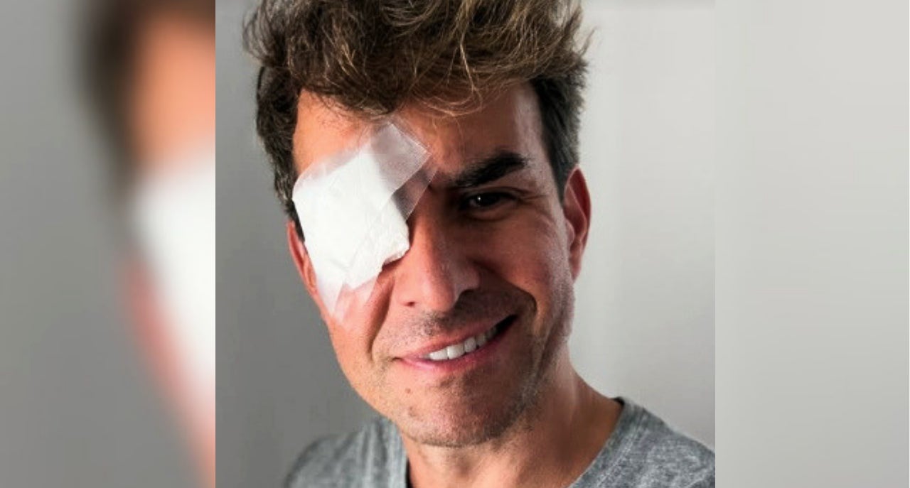 El gendre de Joan Manuel Serrat, amb un problema ocular impactant - Instagram