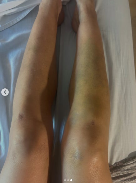 Les fotos que ha compartit l'actriu són impactants - Instagram