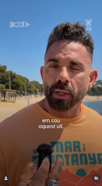 Marc Ribas confessa el problema que té a l'ull - Instagram