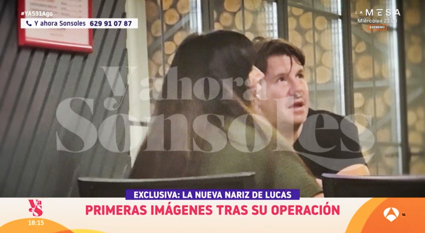 Primeres imatges de Lucas després d'una altra operació de nas - Antena 3